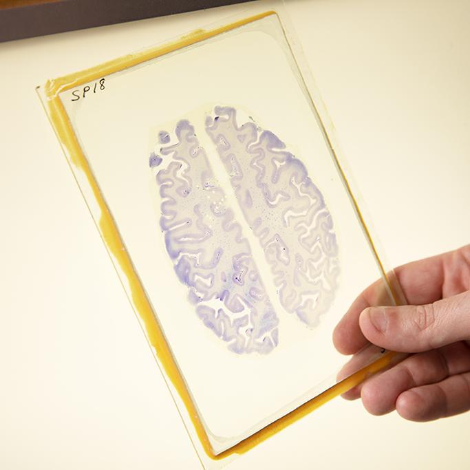 A thin section of a brain on a glass plate